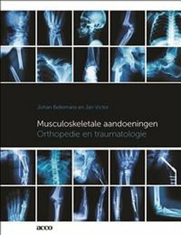 Musculoskeletale aandoeningen | 9789463443890