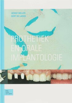Prothetiek en orale implantologie | 9789031341436