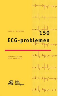 150 ECG-problemen | 9789036813730