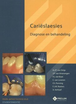 Carieslaesies-studenteneditie | 9789085621355