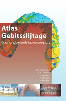 Atlas gebitsslijtage | 9789036805377