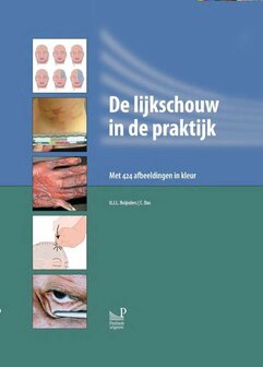 De lijkschouw in de praktijk | 9789085621126