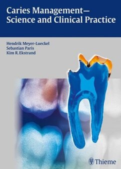 9783131547118 | Caries Management - Science and Clinical Practice